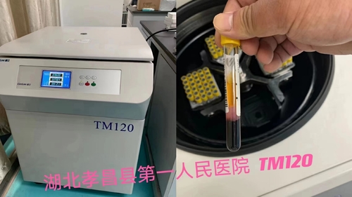Latest company news about Centrigue di PRP