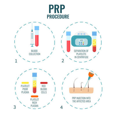 Un buon prezzo. Veterinary Medicine:** Process animal blood for PRP therapies in equine and canine sports medicine. in linea